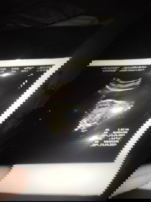 Bentuk kantung tidak bulat