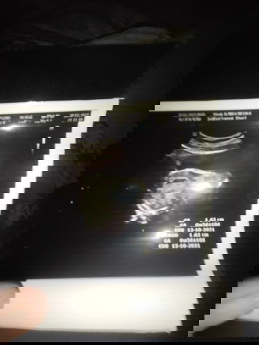 Bentuk kantung tidak bulat