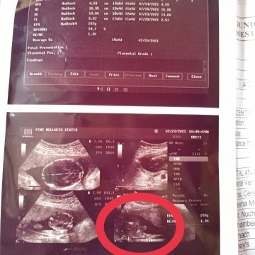 20weeks & 2Days π
TEAM JULY β
ITS A BABY BOY AGAIN! π¬π