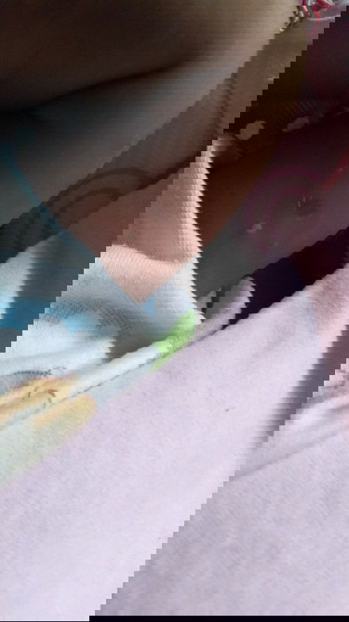 Benjolan seperti kena api