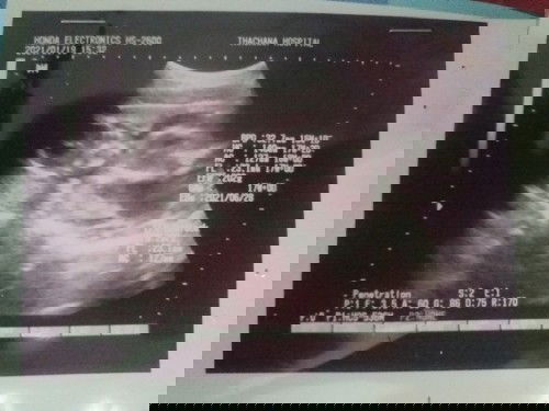 เจ้าตัวน้อย22w2d