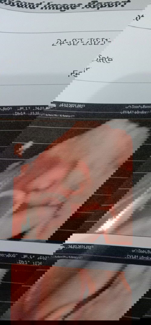 Alhamdulillah sudah lega, akibat banyak fikiran dan kemaren flek 🤲