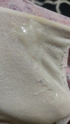Mucus plug
