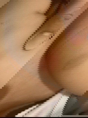 Kagat po ba ito ng ipis?