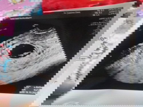 สอบถามแม่ๆคะ