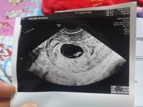 สอบถามแม่ๆคะ