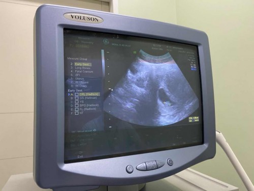 อายุครรภ์ไม่ตรง