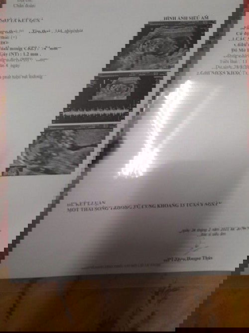 Khám thai lần hai...13Tuan
Phòng khám sản phụ khoa Trung Tuấn..P. Hiệp Thành_ Q 12
