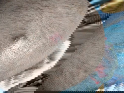 Da đầu bé có nổi màu hồng đỏ