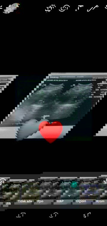 USG kemarin 24 februari