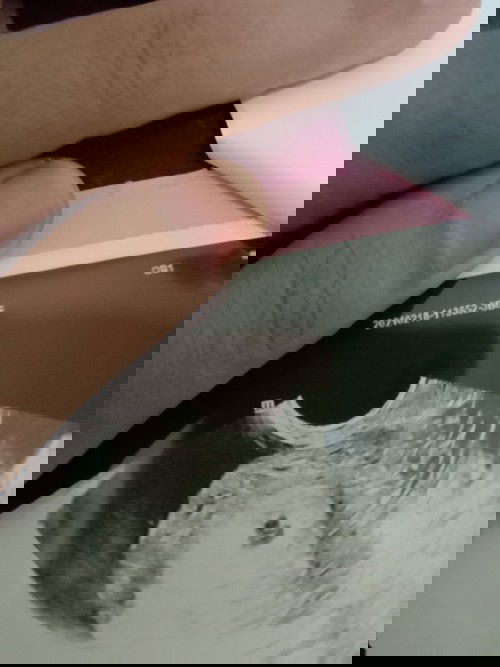 Hasil USG usia kandungan 3 minggu