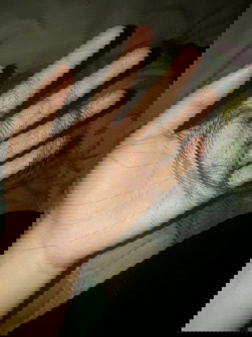 Rambut rontok pasca melahirkan