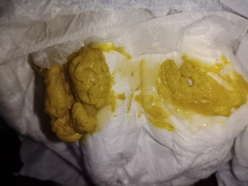POOP