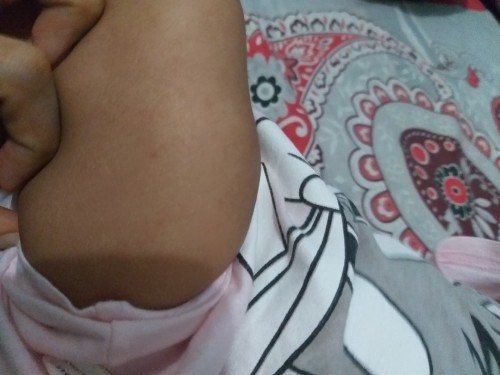 Imunisasi