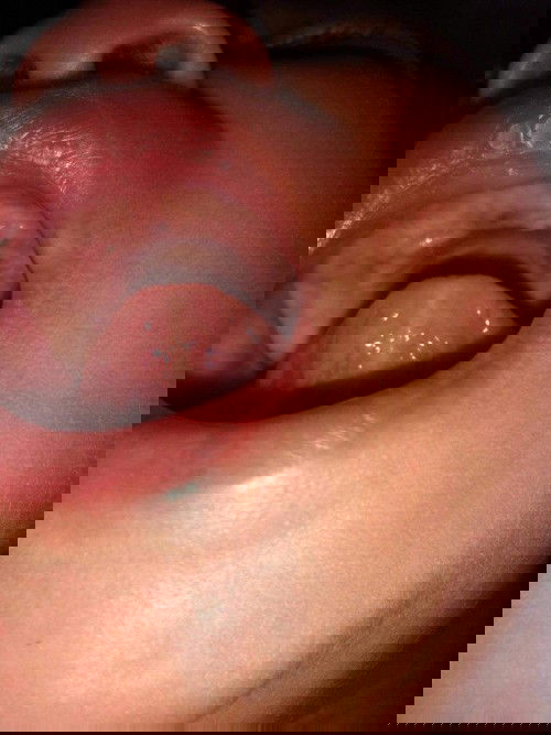 เกี่ยวกับปากลูกน้อย