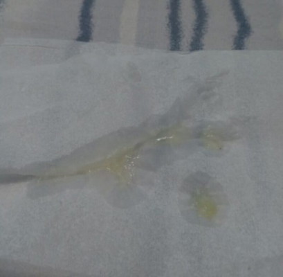 Tanda mau melahirkan