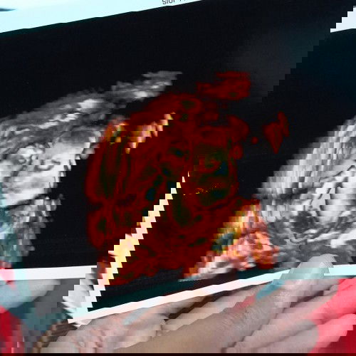 HPL MEI MANA SUARANYA NIH?