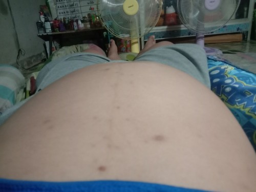 มีใครเป็นบ้างไหมคะ