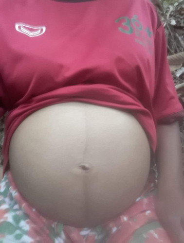 ตอนนี้อายุครรภ์26w5d ท้องกลมแต่สะดือคว่ำ อยากทราบว่าจะได้ลูกผู้ชายหรือผู้หญิงคะ ท้องแรกคะ