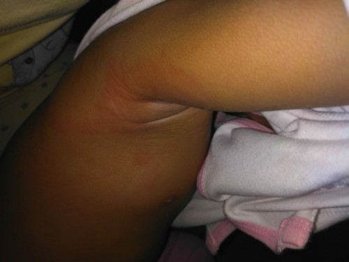 Tanya penyebab merah knpa