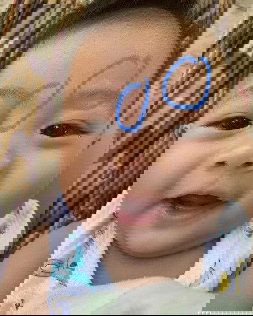 แม่ๆนี่ใช่กลากน้ำนมมั้ยคะ?