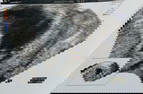 ความทรงจำช่วงสั้นๆ น้องไม่อยู่กับแม่แล้ว