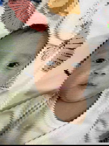 Face Rashes