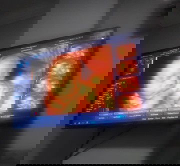 Prediksi Jenis Kelamin Berubah