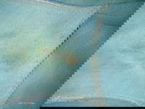 Flek apa ya bund 🤔