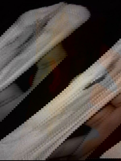 Pregnant, Smelly Discharge