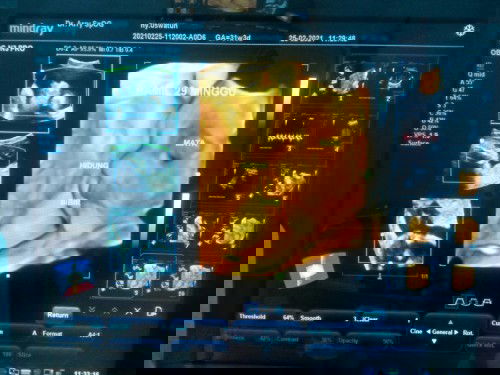 kemaren habis usg dan kata dokter uk masih 29w sedngkn dari bidan uk sudah 31w4d..