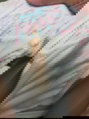 Worried na ako anu kaya to mga mommies lagi may lumalabas sa panty ko na ganyan normal po ba yan????