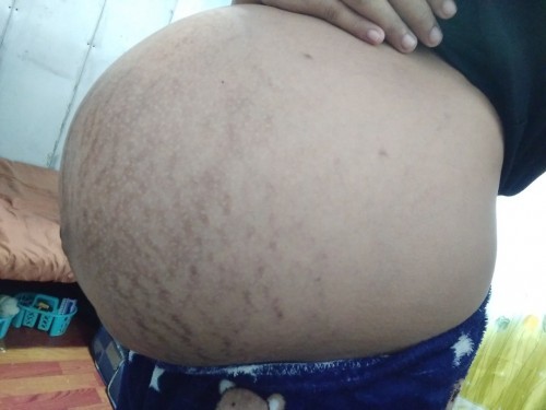 Malaki po ba talaga ang tyan ko mga momsh. dami kasi nagsabi eh 39 weeks and6 days ako ngayon