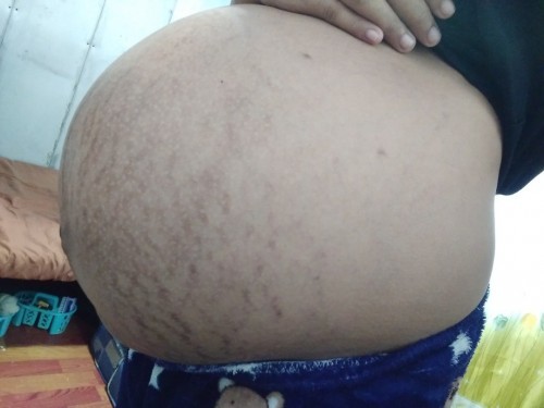 Malaki po ba talaga ang tyan ko mga momsh.  dami kasi nagsabi eh 39 weeks and6 days ako ngayon