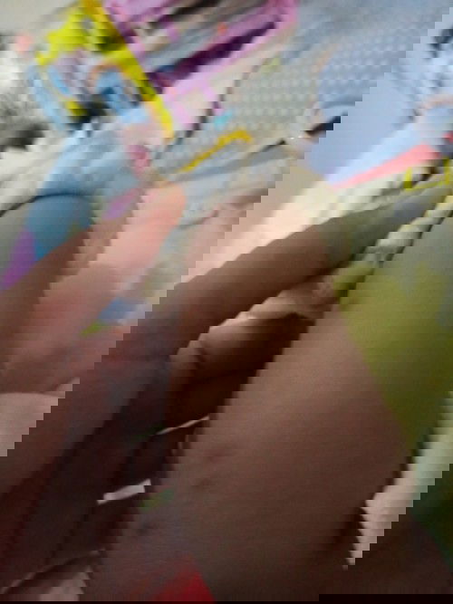 Bekas gigitan nyamuk