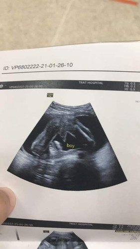 สอบถามเรื่องเพศลูก