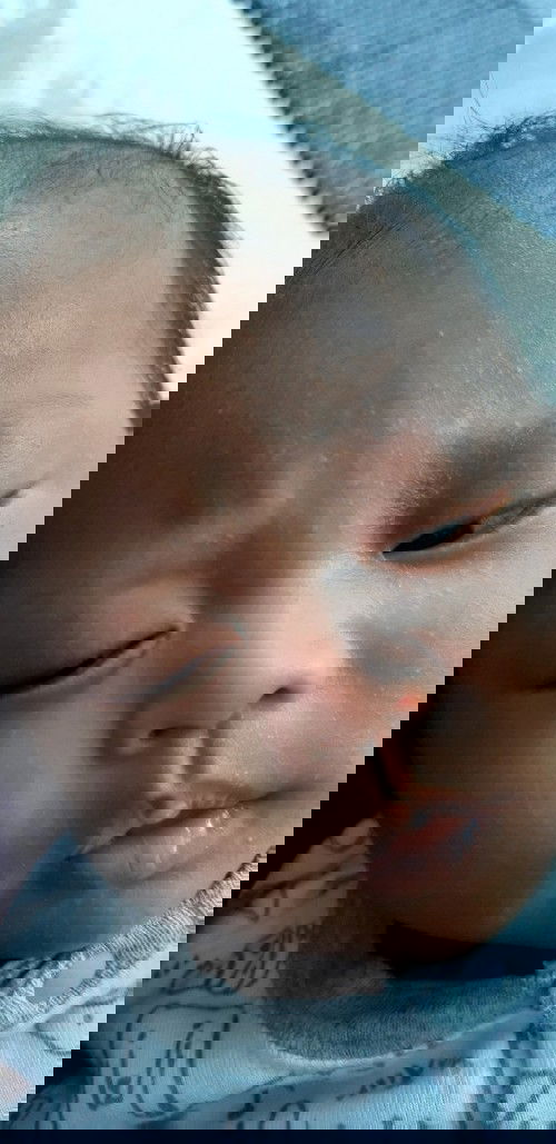 Muka bayi beruntusan