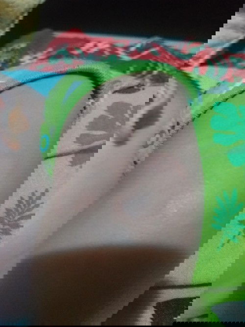 Iritasi pada kulit bayi