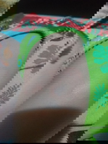 Iritasi pada kulit bayi