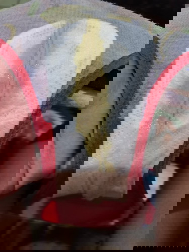 Greenish Discharge