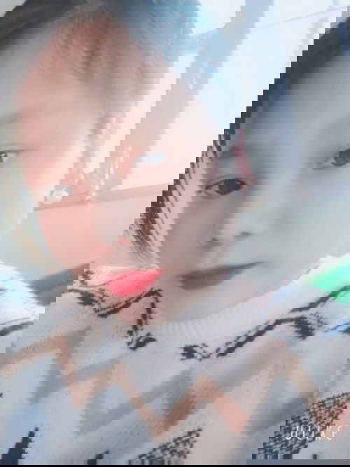 Siêu âm 
123456756