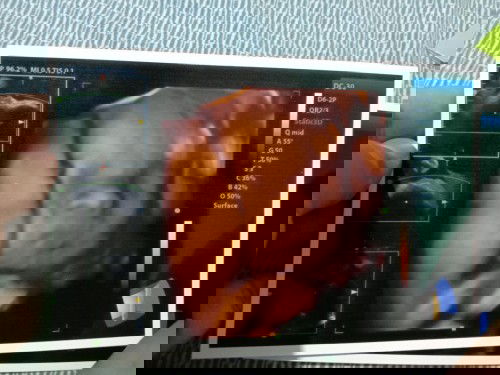 My baby Isaiah Hendrix.