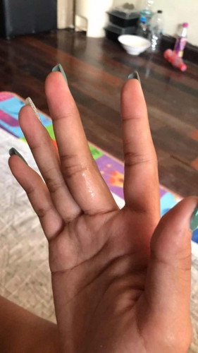 น้ำคร่ำรั่วเป็นยังไงคะ