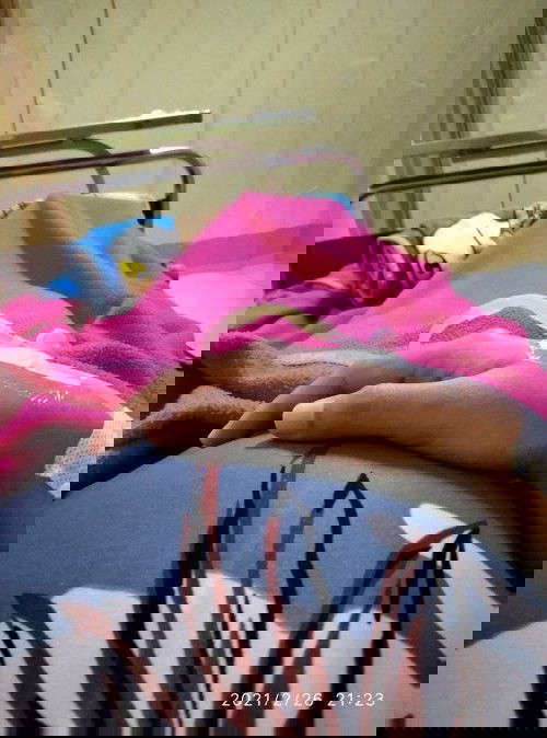 Bayi meninggal dalam kandungan