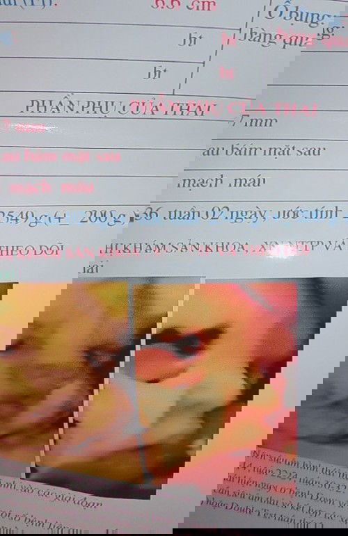 Các mom thông thái