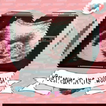 Minta doanya, dan smoga doa untuk saya bisa berbalik kpada bunda" smua aamiin