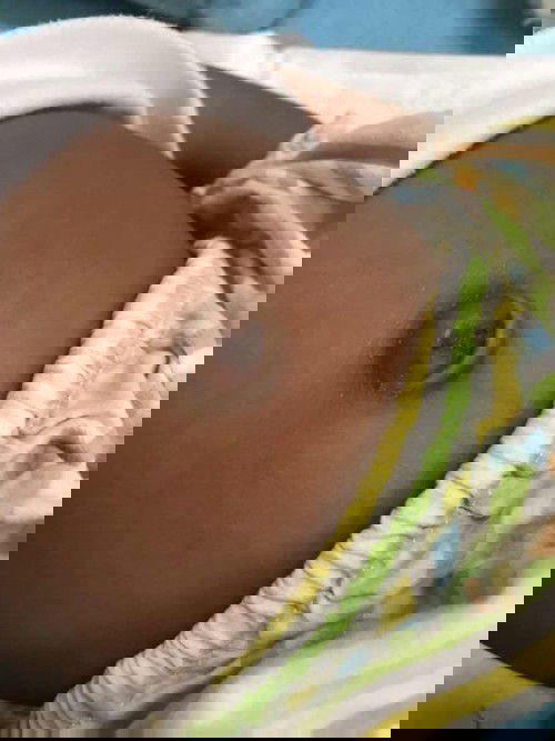 กลัวลูกสะดือจุน