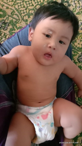 Baby 9 bulan cirit