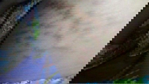 Strechmarks Padahal Ga Digaruk