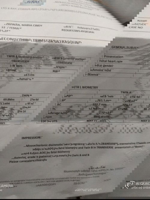 Naway manormal ko ang aking kambal 
#teamMay
#Boy&Girl
#28weekers